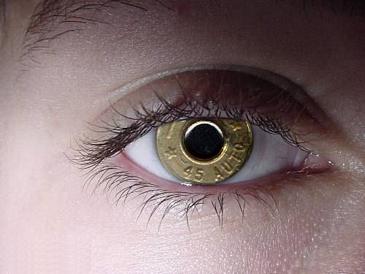 Lente de contacto peculiar